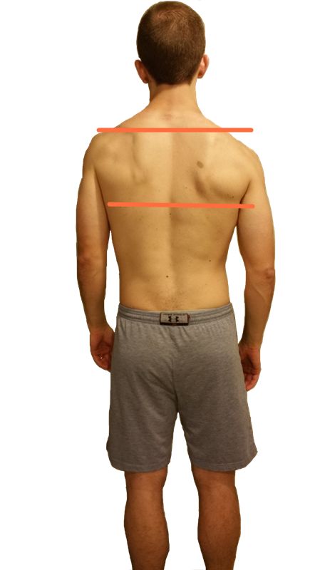 高低肩的最佳矫正方法,高低肩手法纠正视频