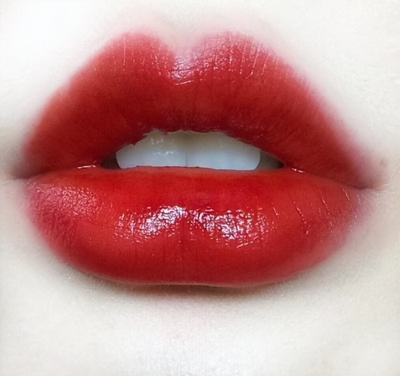 唇部丰满适合哪个医美项目,唇部做什么医美项目才能变浅色