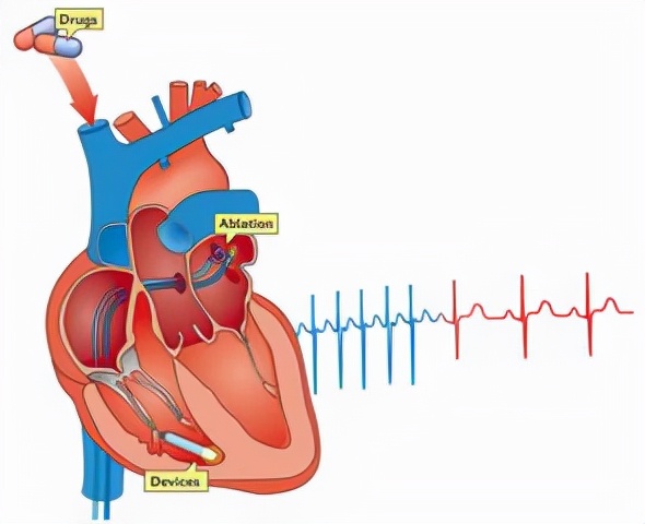 感冒了有什么反应,感冒后千万别做这三件事