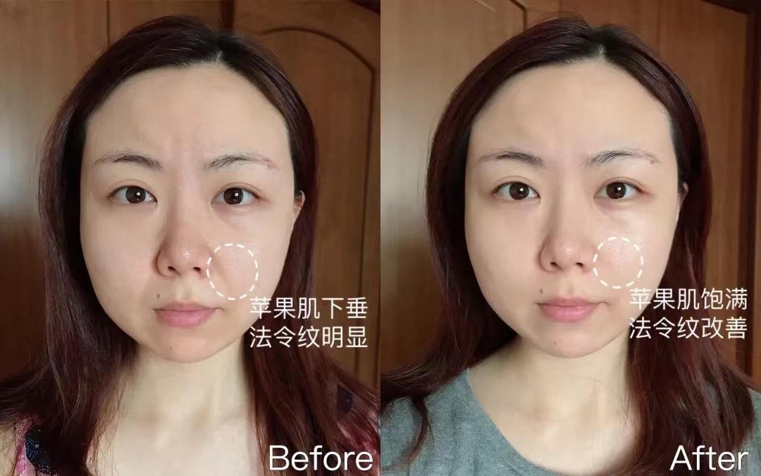 国货大战欧莱雅玻色因,欧莱雅和玻色因哪个好