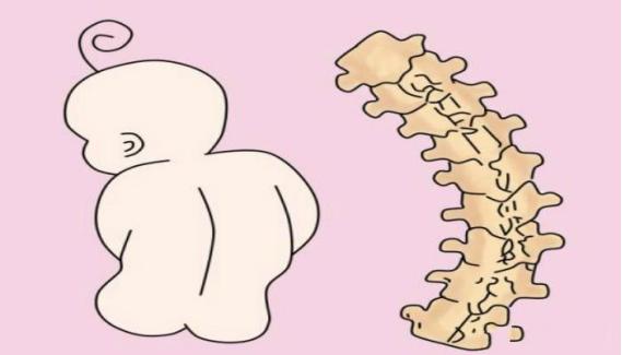 孩子写作业时总是弯腰驼背,孩子弯腰驼背是缺乏微量元素吗