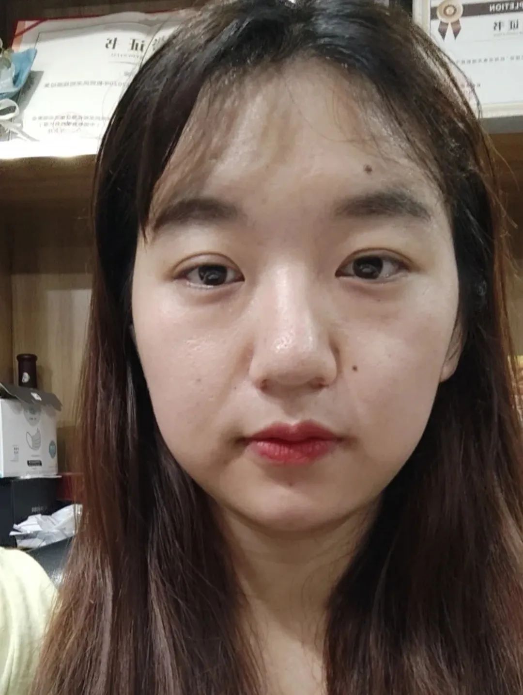 疲惫脸色不好怎么办,疲惫脸补救