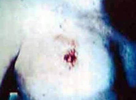 最严重的恋尸癖是欧洲的连环杀手。他杀人的目的是和死人*爱做**。