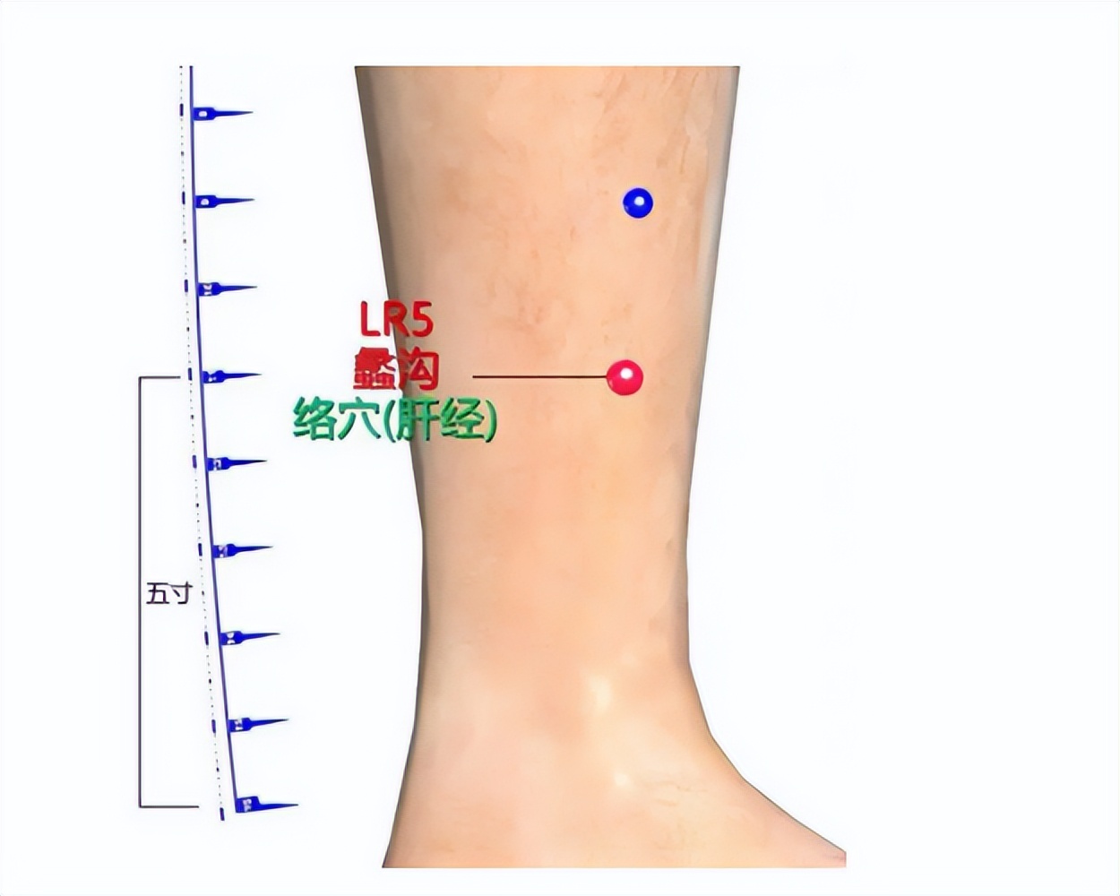 蠡沟穴——调理妇科炎症经验穴