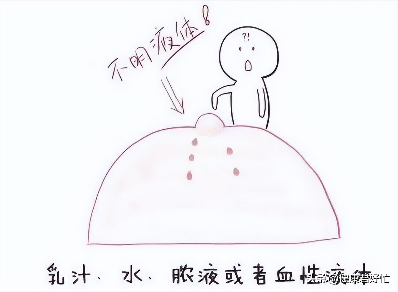 有哪些乳腺知识一定要了解,女生乳腺冷知识