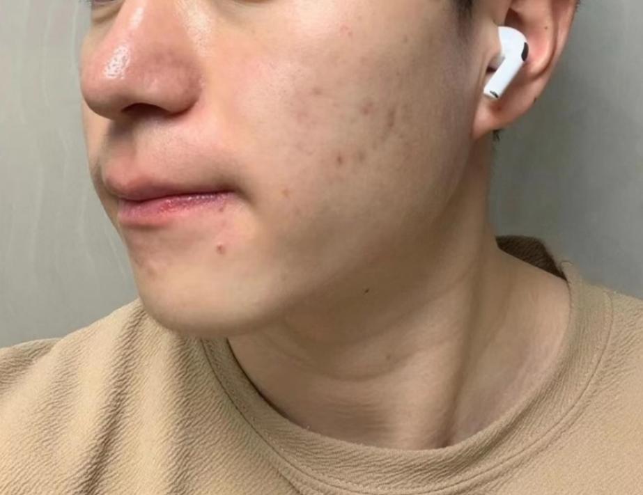 晚上护肤的正确步骤男士,男士从零开始护肤