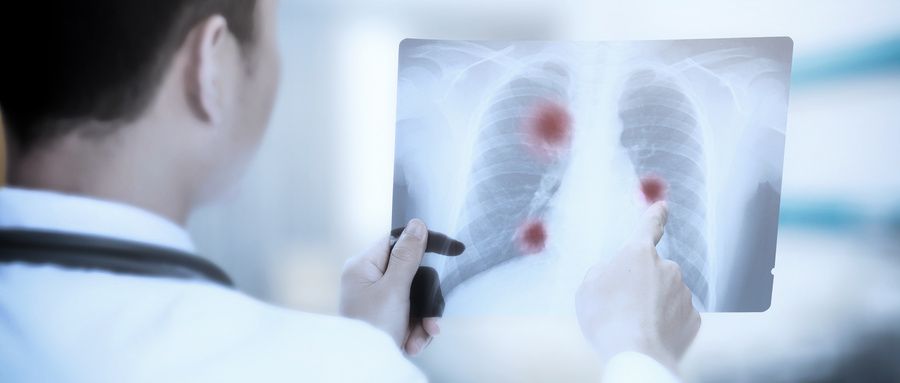 黄云超最新消息,云南省肿瘤医院黄云超医生怎么样