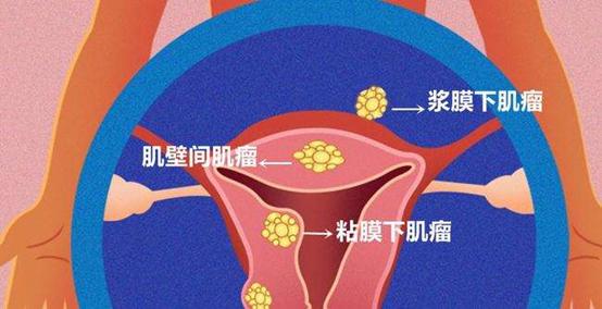 月经拖拖拉拉十几天干净怎么治疗,月经不调提前十天来月经怎么办