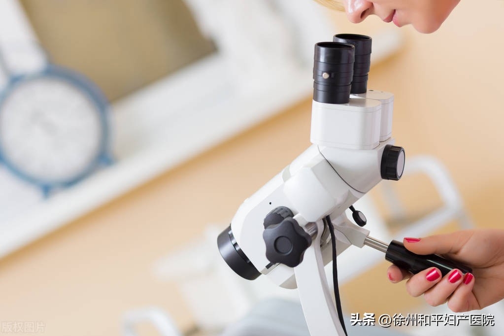 筛查宫颈癌，为什么医生还让我做阴道镜？