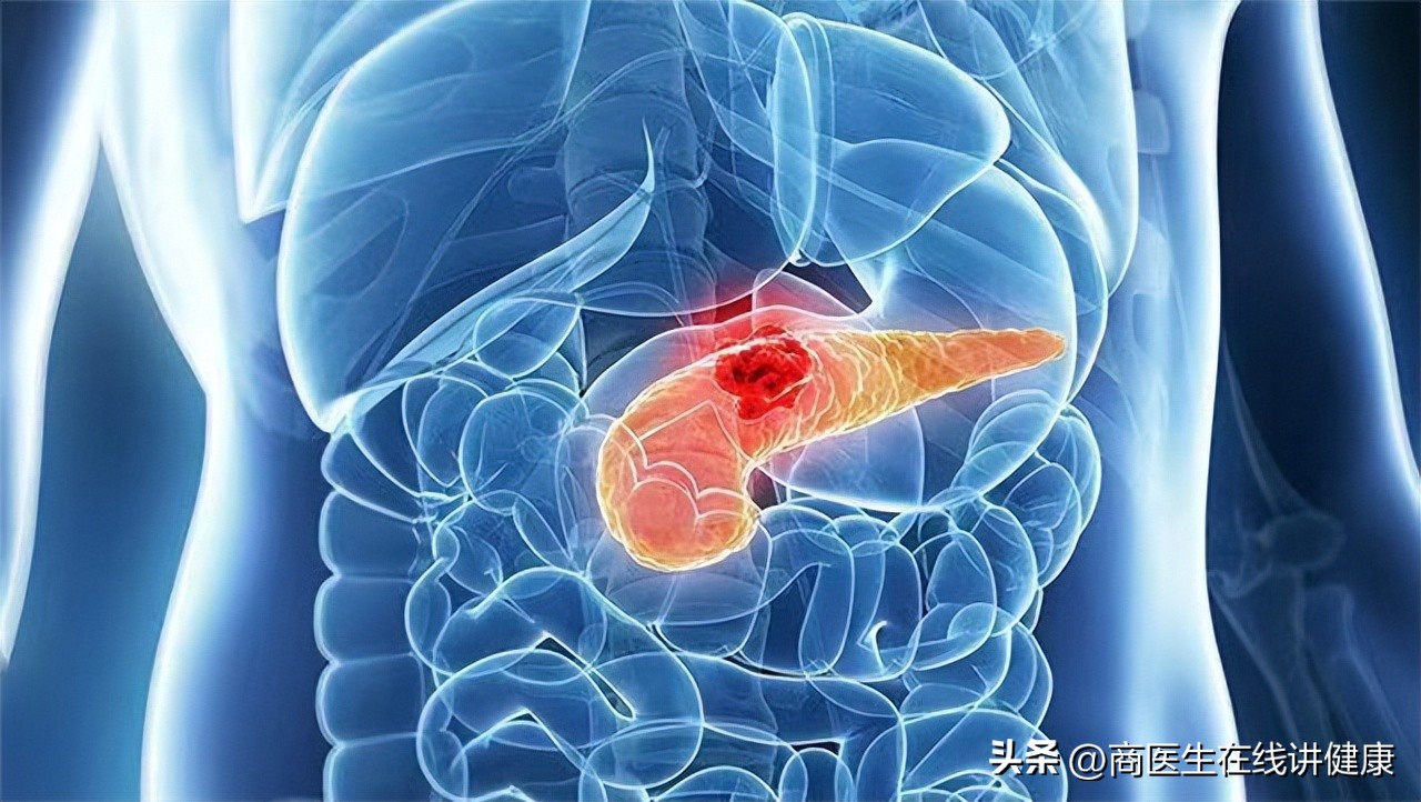 胰腺癌发现就是晚期吗,胰腺癌晚期出现打嗝症状怎么治疗