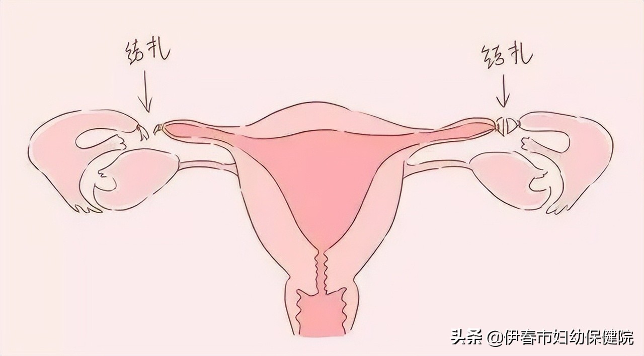 「健康科普」怎样避孕才最合理？