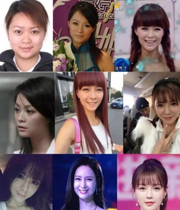 这些整容后都逆袭的女明星,盘点全网那些整容失败的女明星