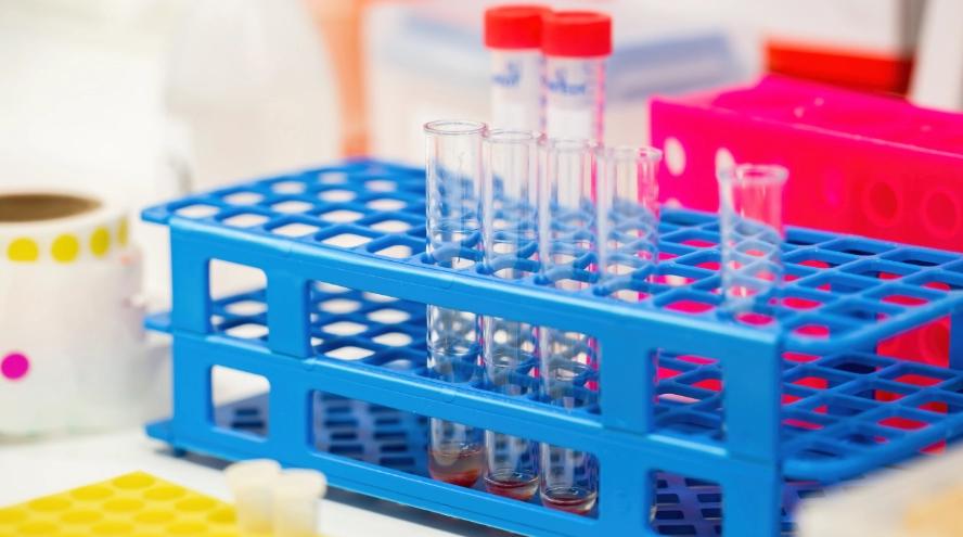 正确留取标本视频,常见标本采集与注意事项ppt