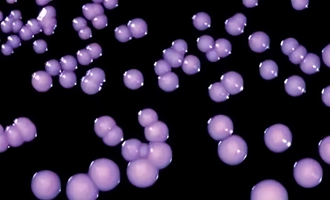 金黄色葡萄球菌的微生物特性,金黄色葡萄球菌的培养特性