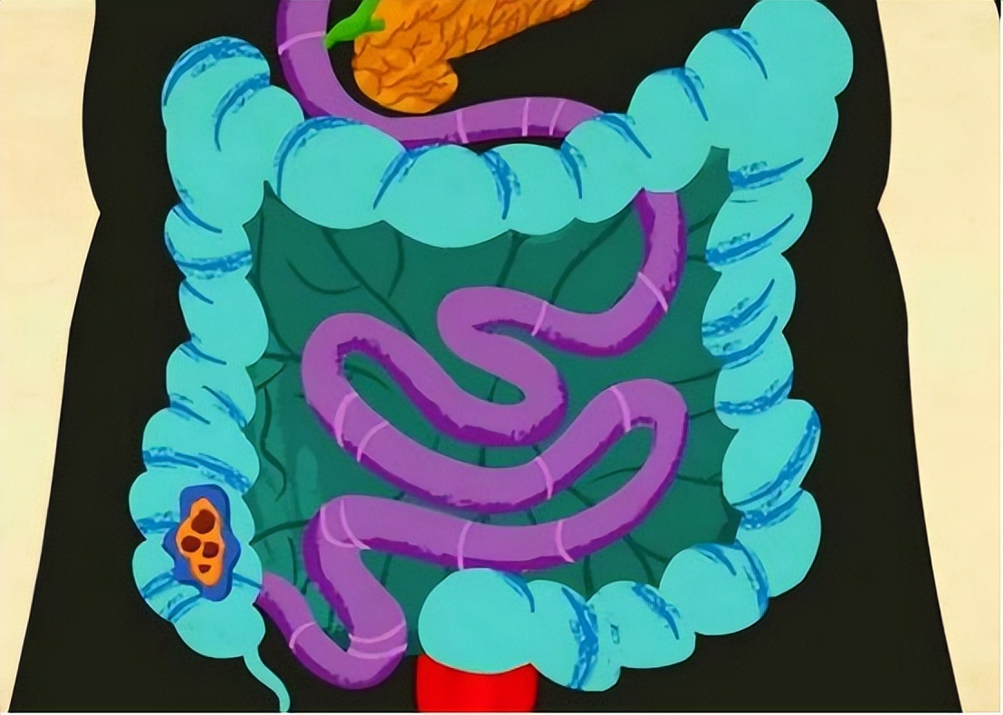 几块钱一片的通便药,润肠通便药几块钱