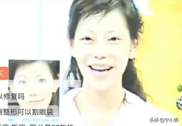 整容达人200次整容失败整成僵尸,整容成功逆袭案例削骨