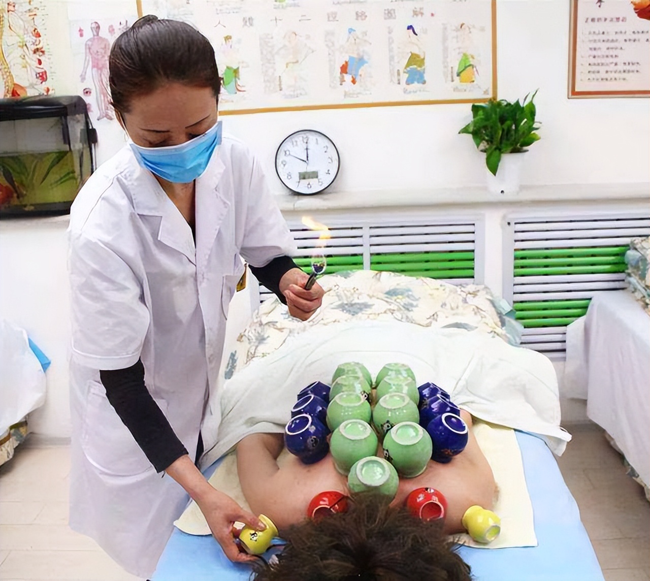 老中医拔火罐的正确方法,中医提醒拔火罐警惕四个禁忌