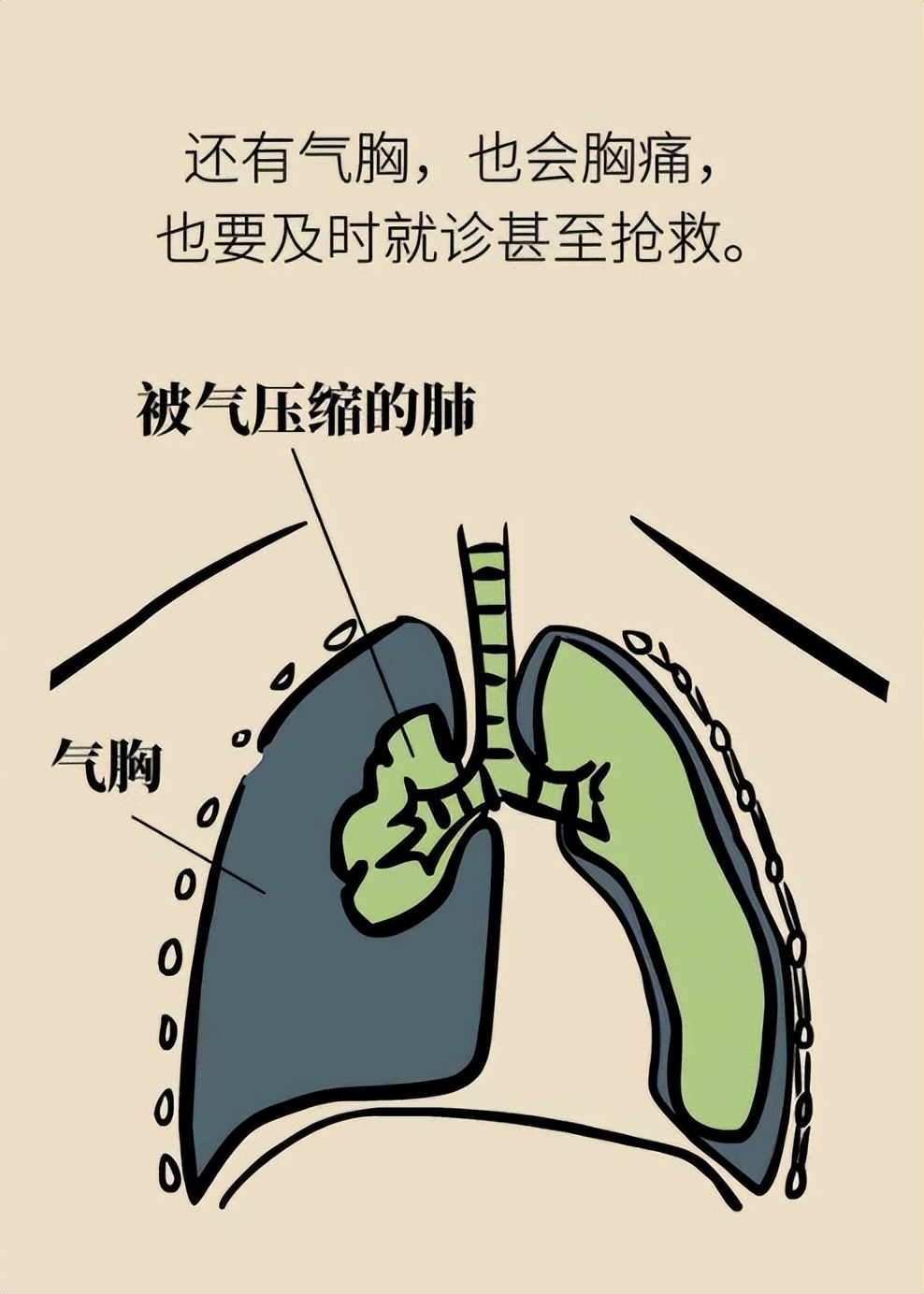 空气中的气体科普,空气栓塞科普