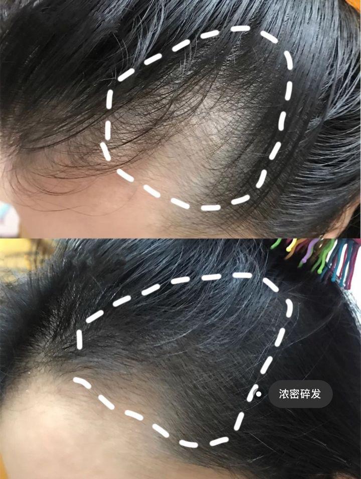 防脱发洗发水排名第一真实测评,洗发水推荐2022公认最好的洗发水