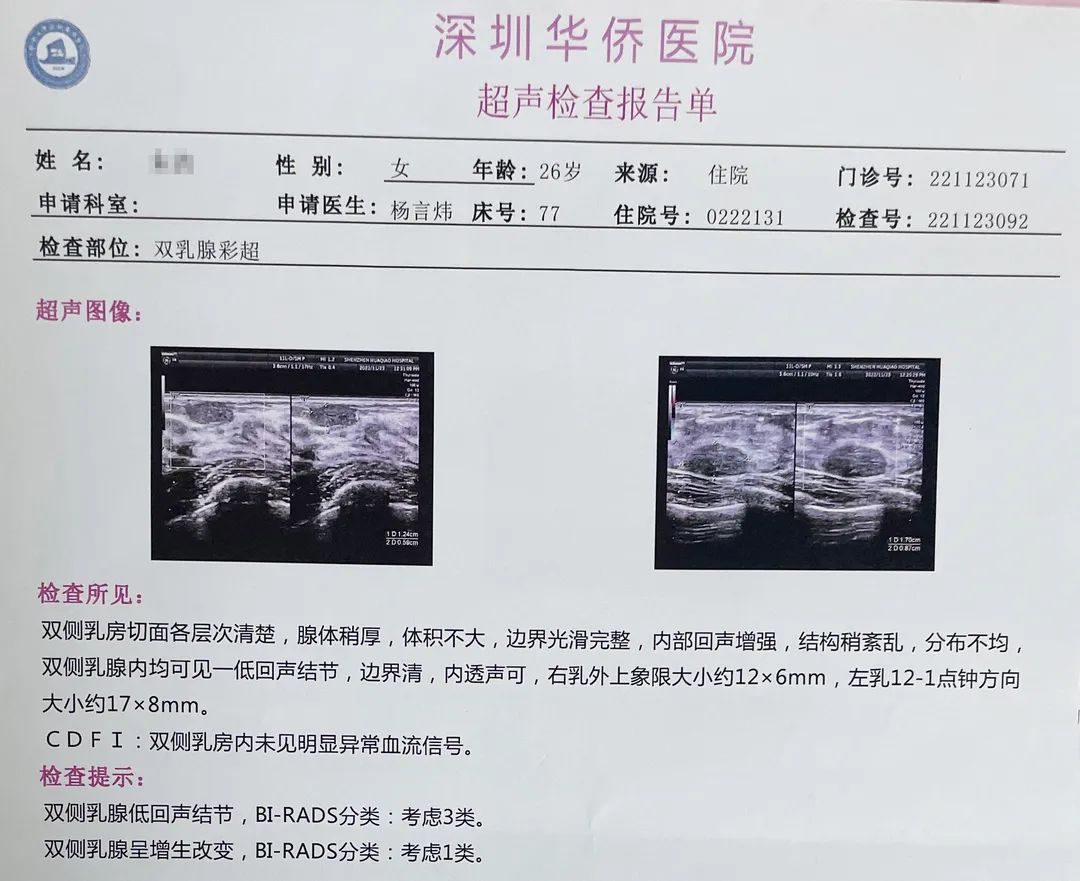 微波消融乳腺结节效果怎么样,乳腺结节不用慌