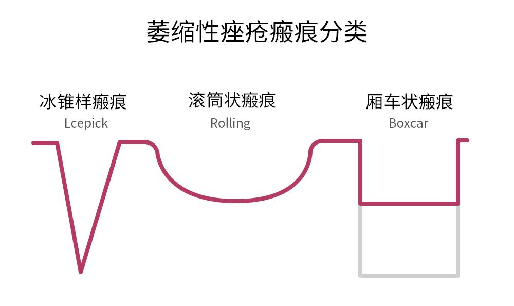 黄金微针能永久收毛孔吗,黄金微针是不是越肿效果越好