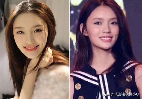 刘涛做的是全瓷牙还是烤瓷牙,刘涛做烤瓷牙的前后对比图