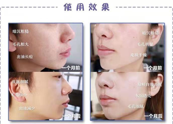 兰蔻极光焕白精华水乳小样,兰蔻极光水乳精华淡斑