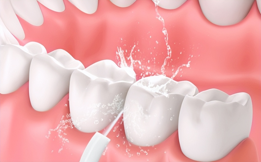 冲牙器的危害有哪些,冲牙器长期使用有危害吗