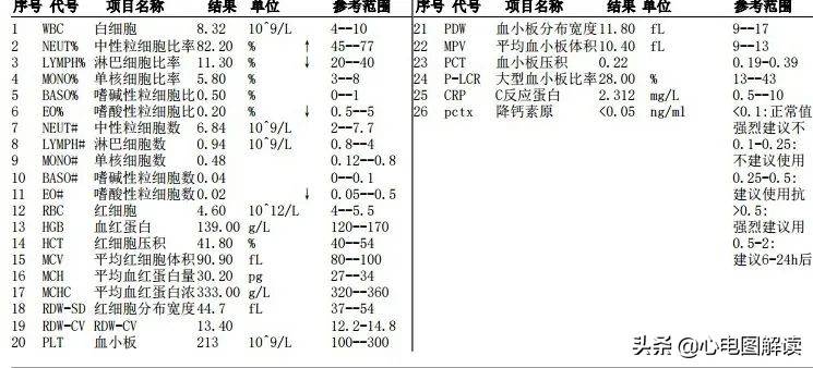 多源性心律过速正常人有吗,多形性室性心动过速