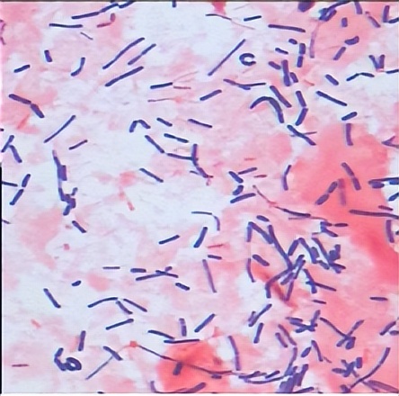 派特灵生物,派特灵生物讲解