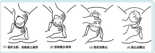 孕妈妈怎么判断胎位是正的,胎儿屁股在右侧是什么胎位