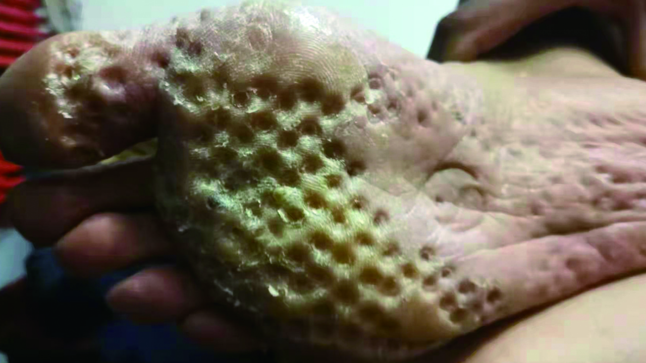 养生等于预防疾病,坚持养生保健的好处