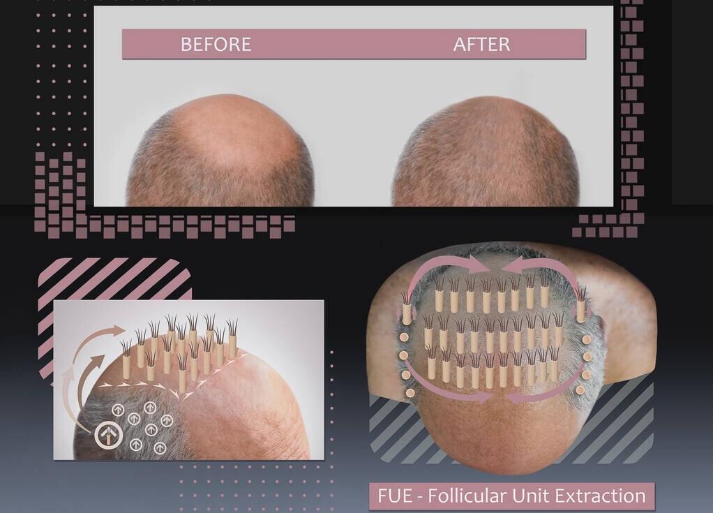 头顶头发稀少怎么变浓密药物,如何让头顶头发不稀少