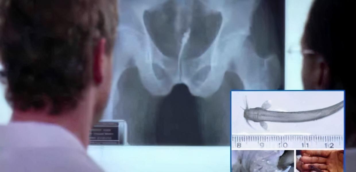 可怕的牙签鱼：嘴上长倒勾，会钻进男人丁丁，拽都拽不出来