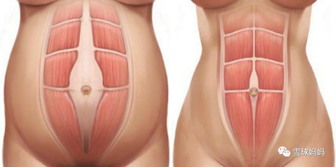 被吐槽“尿频”汤唯现场落泪，产后尿频、漏尿应当被知道得更多..
