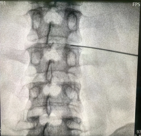 甘肃庆阳市庆城县岐伯中医医院,庆城县岐伯中医院新消息