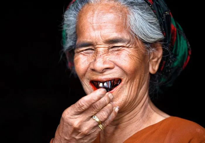 槟榔的危害口腔癌患者吃十年,槟榔的危害口腔癌患者自述