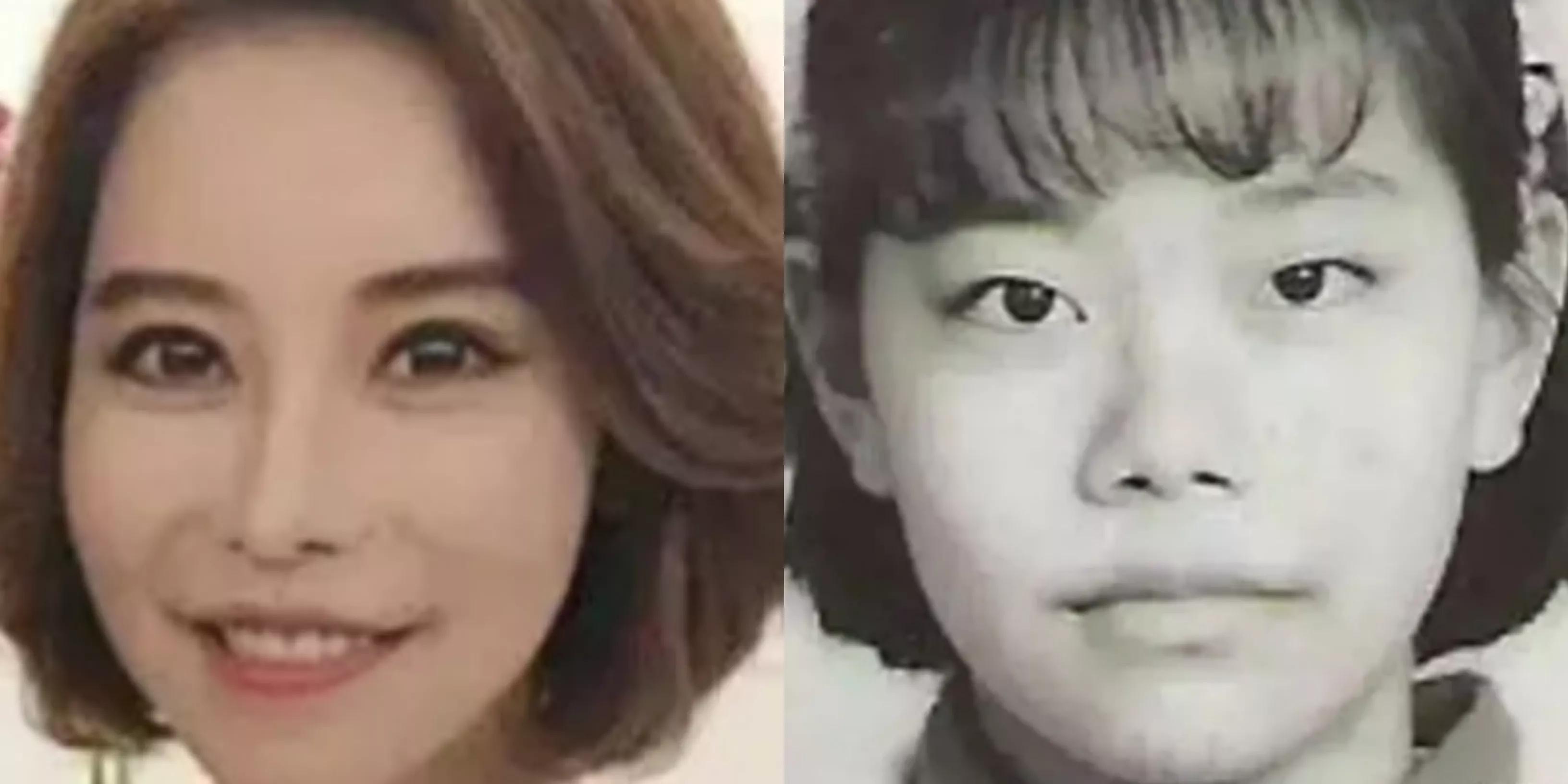 盘点那些整容整的最厉害的人,整容整的最厉害的三位女士