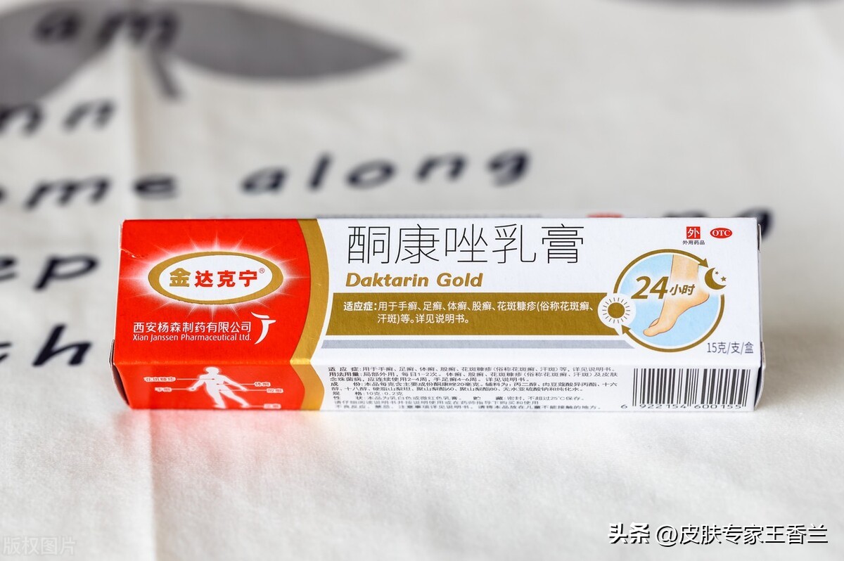 复方酮康唑乳膏可以治脚气吗,复方酮康唑和达克宁治脚气
