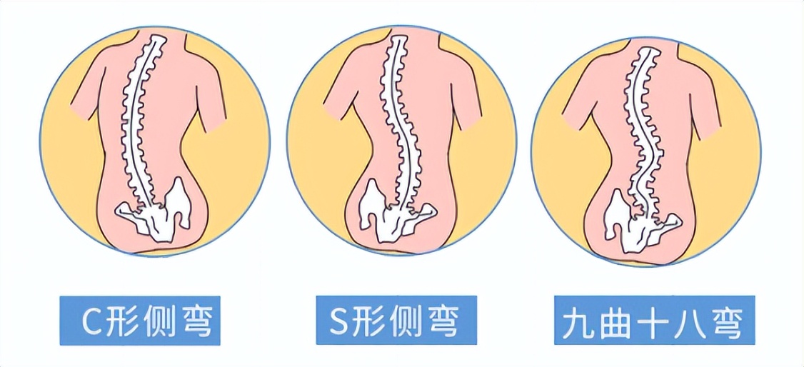 腰酸背痛算不算工伤,上班期间突然腰痛得厉害算工伤吗