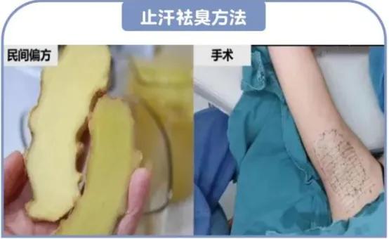 公认好用的止汗露,真实有效的止汗露