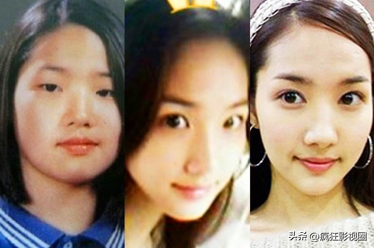 韩国整容最成功的明星朴敏英,朴敏英自曝整容史