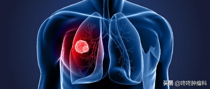 ntrk基因融合新药,最新ret突变新药