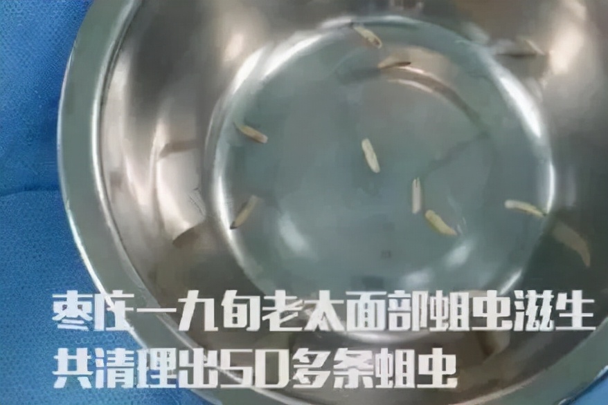 卫生间小飞虫蛾蚋的危害,卫生间小飞虫有多可怕