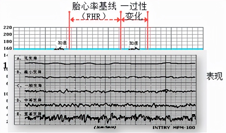 孕妈妈需要经历什么,从怀孕到生需要做多少次产检