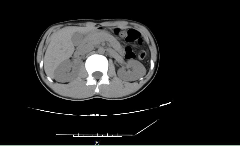 过敏性紫癜到皮肤病医院看可以吗,过敏性紫癜是血液病还是皮肤病
