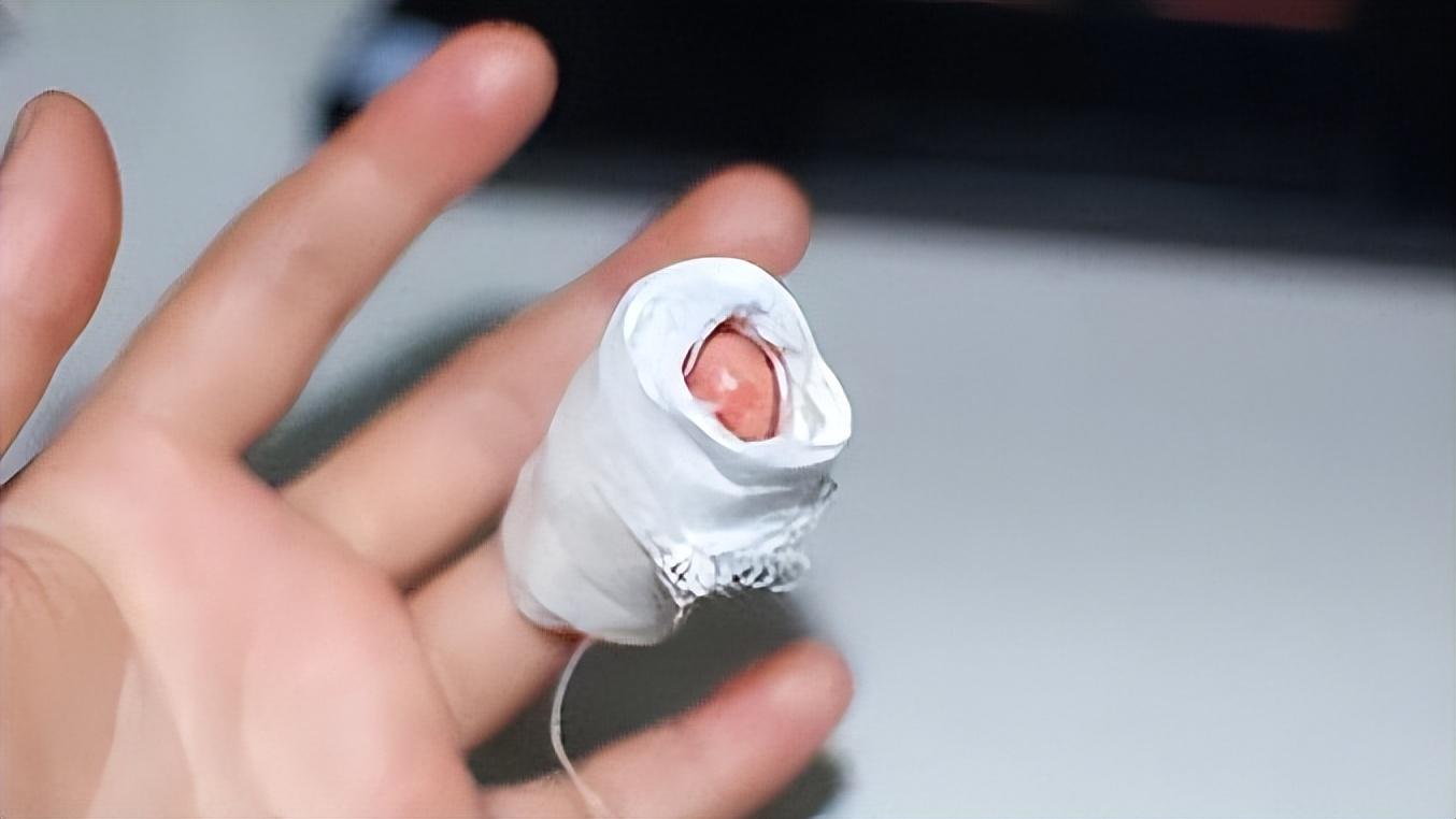 动物急救,动物急救视频大全