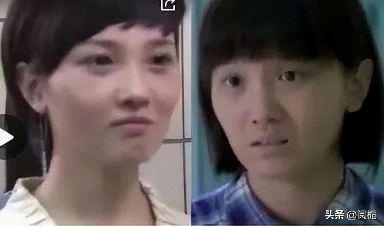 靠换脸逆天改命的六位女星,长得歪瓜裂枣整得美若天仙的明星