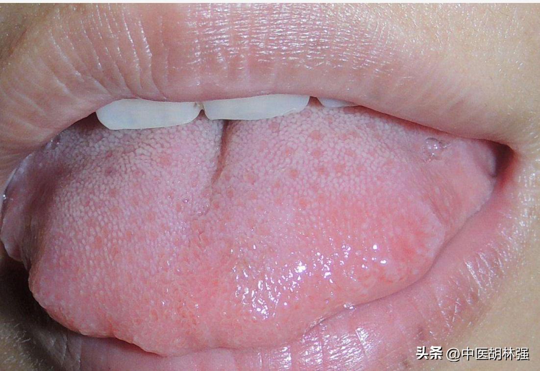 入夏潮热湿气重，浑身难受，教你几招清理全身湿气，一身轻松。