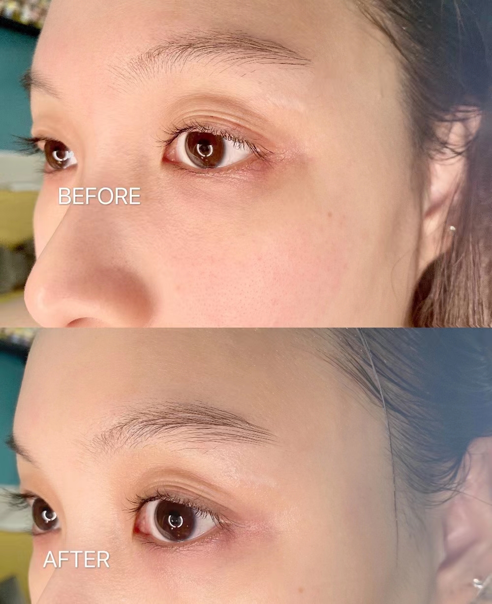 十大公认最好用的面膜品牌,最火的面膜lv